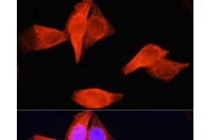 Immunofluorescence analysis of HeLa cells using PSAT1 Polyclonal Antibody at dilution of 1:100 (40x lens). (PSAT1 anticorps)