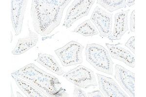 Immunohistochemistry (IHC) image for anti-Kruppel-Like Factor 4 (Gut) (KLF4) (AA 75-125) antibody (ABIN7795639) (Recombinant KLF4 anticorps  (AA 75-125))