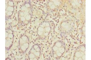 Immunohistochemistry of paraffin-embedded human colon tissue using ABIN7170174 at dilution of 1:100 (SLC23A2 anticorps  (AA 1-90))