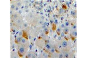 Used in DAB staining on fromalin fixed paraffin-embedded Liver tissue
