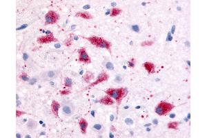 Anti-CRF1 antibody IHC of rat hypothalalmus.