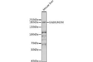 Western blot analysis of extracts of mouse brain, using ErbB4/HER4 antibody (ABIN6131263, ABIN6140257, ABIN6140260 and ABIN6221732) at 1:1000 dilution.