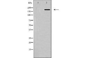 Western blot analysis of MYLK expression in HepG2 cells. (MYLK anticorps  (C-Term))