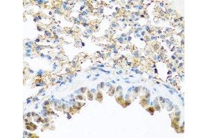 Immunohistochemistry of paraffin-embedded Mouse lung using PI3 Polyclonal Antibody at dilution of 1:100 (40x lens). (PI3 anticorps)