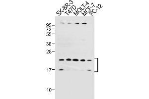 All lanes : Anti-UBE2W Antibody (C-term) at 1:1000 dilution Lane 1: SK-BR-3 whole cell lysate Lane 2: T47D whole cell lysate Lane 3: MOLT-4 whole cell lysate Lane 4: MCF-7 whole cell lysate Lane 5: PC-12 whole cell lysate Lysates/proteins at 20 μg per lane.