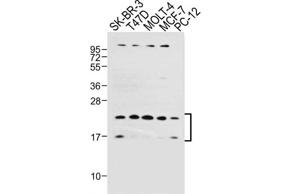 UBE2W Antikörper  (C-Term)