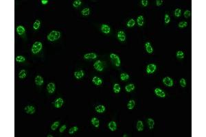 Immunofluorescence staining of Hela cells with ABIN7127685 at 1:100,counter-stained with DAPI. (Recombinant CREB1 anticorps  (pSer133))