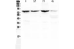 Western blot analysis of Calpain 2 using anti-Calpain 2 antibody . (Calpain 2 anticorps  (AA 500-700))