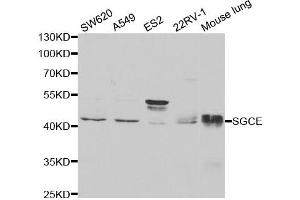 Western Blotting (WB) image for anti-Sarcoglycan, epsilon (SGCE) antibody (ABIN1876518) (SGCE anticorps)