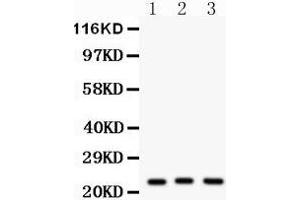 Western Blotting (WB) image for anti-Peroxiredoxin 5 (PRDX5) (AA 66-198) antibody (ABIN3043906) (Peroxiredoxin 5 anticorps  (AA 66-198))