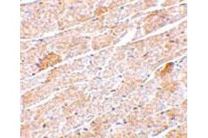 Immunohistochemistry of NRN1 in mouse heart tissue with NRN1 polyclonal antibody  at 5 ug/mL .