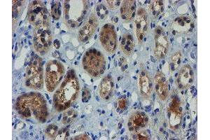 Image no. 4 for anti-Zinc Finger Protein 365 (ZNF365) (AA 108-407) antibody (ABIN1490829)