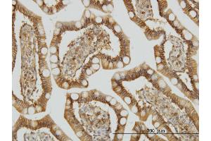 Immunoperoxidase of monoclonal antibody to TRAF3IP2 on formalin-fixed paraffin-embedded human small Intestine.