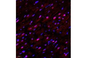 Immunofluorescence of paraffin embedded rat heart using NAIF1 (ABIN7074867) at dilution of 1:650 (400x lens)