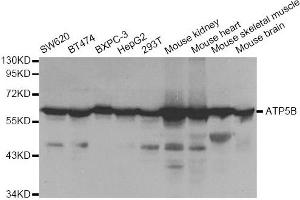 Western blot analysis of extracts of various cell lines, using ATP5B antibody. (ATP5B anticorps)
