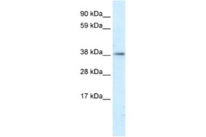 Western Blotting (WB) image for anti-Proteasome (Prosome, Macropain) 26S Subunit, Non-ATPase, 11 (PSMD11) antibody (ABIN2460632) (PSMD11 anticorps)