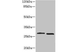Western blot All lanes: CRYBB1 antibody at 1. (CRYBB1 anticorps  (AA 1-252))