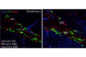 Immunohistochemistry of Mouse anti-p53 antibody.
