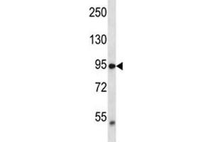 TRPV2 antibody western blot analysis in MDA-MB435 lysate.