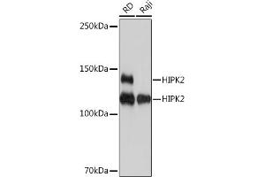 Western blot analysis of extracts of various cell lines, using HIPK2 Rabbit mAb (ABIN7267779) at 1:1000 dilution. (HIPK2 anticorps)