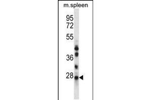 Western blot analysis in mouse spleen tissue lysates (35ug/lane). (NQO2 anticorps  (N-Term))