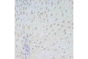 Immunohistochemistry of paraffin-embedded human esophagus using TCEB2 antibody (ABIN6131621, ABIN6148934, ABIN6148936 and ABIN6217328) at dilution of 1:100 (40x lens).