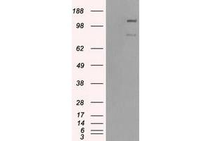 HEK293T cells were transfected with the pCMV6-ENTRY control (Left lane) or pCMV6-ENTRY BUB1B (Right lane) cDNA for 48 hrs and lysed. (BUB1B anticorps)