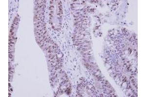 anti-Zinc Finger Protein 329 (ZNF329) (AA 1-202) antibody