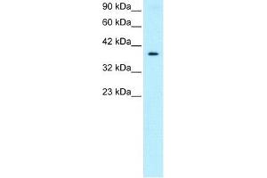 Human HepG2; WB Suggested Anti-NT5C3 Antibody Titration: 0. (NT5C3 anticorps  (Middle Region))