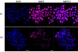 Immunocytochemical staining of HeLa cells using SMC3 antibody (ABIN7800448), 1:1,000), Top panel: wild-type (WT), Bottom panal: SMC3 shRNA knockdown (KD). (Recombinant SMC3 anticorps)