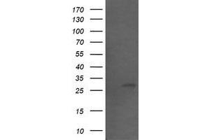 Image no. 1 for anti-Src-like-adaptor 2 (SLA2) antibody (ABIN1500952) (SLAP2 anticorps)