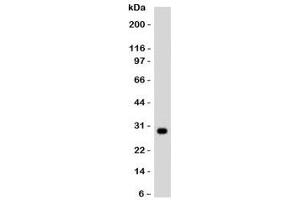 Western blot testing of Ramos lysate and HLA-DRB1 antibody. (HLA-DRB1 anticorps)