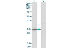 Western Blot analysis of GINS2 expression in transfected 293T cell line by Pfs2 monoclonal antibody (M02), clone 3H4. (GINS2 anticorps  (AA 1-100))