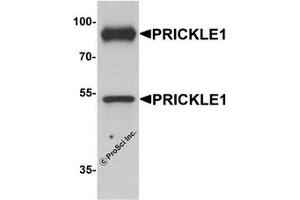 Western Blotting (WB) image for anti-Prickle-Like Protein 1 (PRICKLE1) (C-Term) antibody (ABIN1077370) (PRICKLE1 anticorps  (C-Term))
