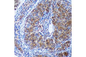 Immunohistochemistry of paraffin-embedded Rat ovary using GULP1 Rabbit pAb (ABIN6131564, ABIN6141541, ABIN6141542 and ABIN6220256) at dilution of 1:100 (40x lens).