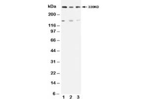 Western blot testing of ATM antibody and Lane 1:  rat testis (ATM anticorps  (N-Term))