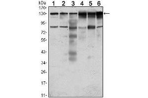 Western Blot showing PTK7 antibody used against Hela (1), A431 (2), HCT116 (3), Caco2 (4), HepG2 (5) and MCF-7 (6) cell lysate.