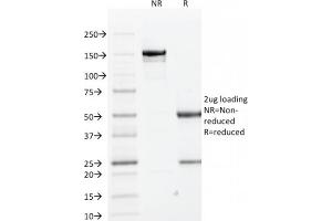 SDS-PAGE Analysis Purified Cytokeratin 1 Mouse Monoclonal Antibody (KRT1/1840). (Cytokeratin 1 anticorps)