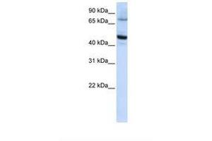 Image no. 1 for anti-Cytochrome P450, Family 46, Subfamily A, Polypeptide 1 (CYP46A1) (AA 396-445) antibody (ABIN6738089) (CYP46A1 anticorps  (AA 396-445))