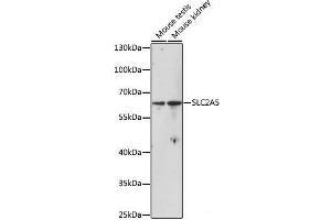 Western blot analysis of extracts of various cell lines using SLC2A5 Polyclonal Antibody at dilution of 1:1000.