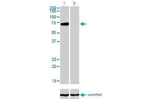 Western blot analysis of PIAS3 over-expressed 293 cell line, cotransfected with PIAS3 Validated Chimera RNAi (Lane 2) or non-transfected control (Lane 1).