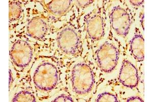 Immunohistochemistry of paraffin-embedded human colon tissue using ABIN7151699 at dilution of 1:100