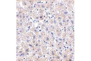 Immunohistochemistry of DRAM in human liver tissue with DRAM antibody at 2. (DRAM anticorps  (C-Term))