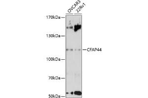 Western blot analysis of extracts of various cell lines, using CF antibody (ABIN7271360) at 1:3000 dilution. (WDR52 anticorps  (AA 180-370))
