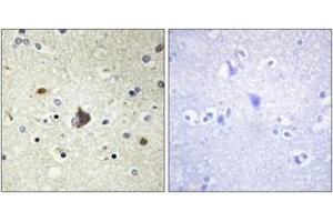 Immunohistochemistry analysis of paraffin-embedded human brain tissue, using Collagen IV alpha3 Antibody.
