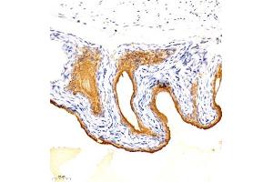 Immunohistochemistry analysis of paraffin embedded mouse bladder using TGDS (ABIN7075850) at dilution of 1: 1500 (TGDS anticorps)