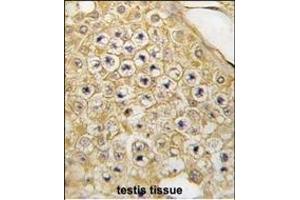 Formalin-fixed and paraffin-embedded human testis tissue reacted with PBK Antibody (C-term ) (ABIN391245 and ABIN2841309) , which was peroxidase-conjugated to the secondary antibody, followed by DAB staining. (PBK anticorps  (C-Term))