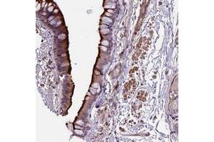 Immunohistochemical staining of human bronchus with ANO3 polyclonal antibody  shows strong cytoplasmic and membranous positivity in respiratory epithelial cells. (ANO3 anticorps)