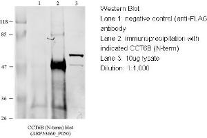 WB Suggested Anti-CCT4 Antibody Titration: 1 ug/mlLane 1: 10ug of HEK293 (CCT6B anticorps  (N-Term))