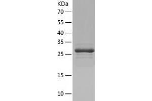 Western Blotting (WB) image for AU RNA Binding Protein/enoyl-CoA Hydratase (AUH) (AA 68-339) protein (His-IF2DI Tag) (ABIN7121948)